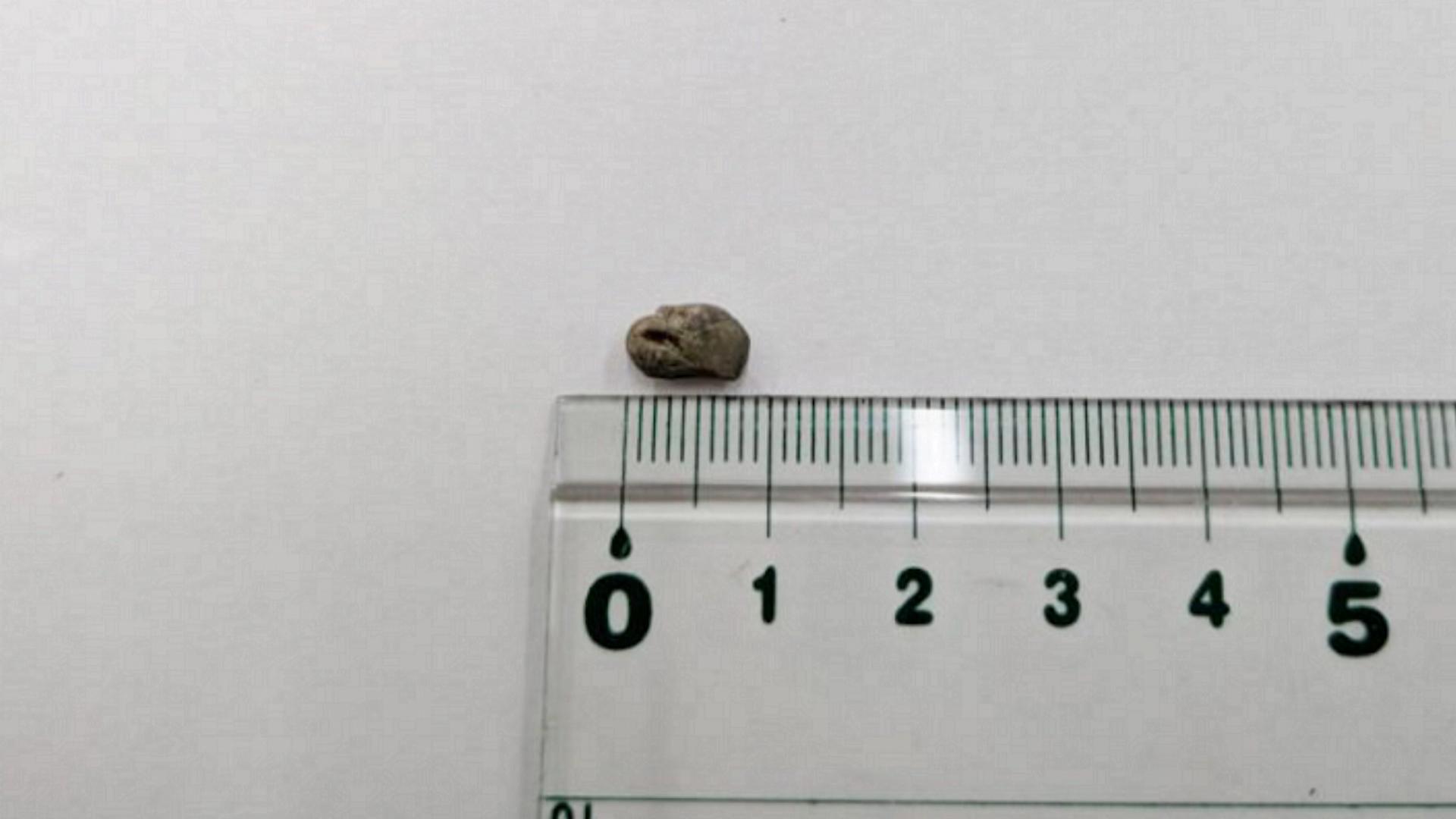 うどんの器の中に石のような異物　保育園で給食に混入